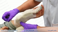 جراحی تاندون دست