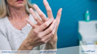 آرتروز انگشتان دست | نحوه تشخیص و علائم + ورزش و درمان قطعی